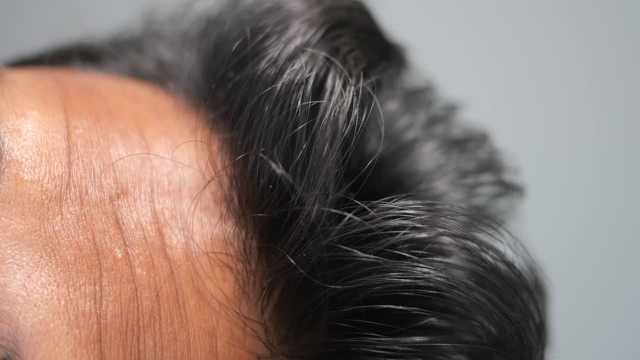 Close-up of graying hair and forehead