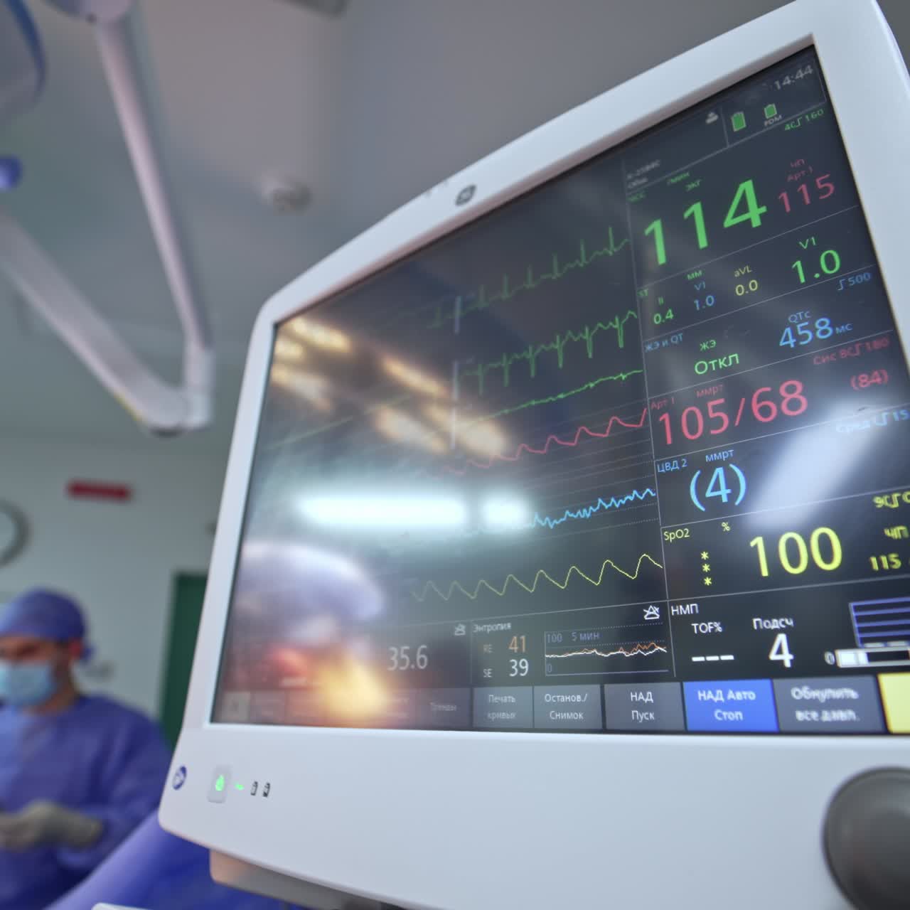 Working lung ventilator during surgical procedure. Life parameters of a patient on the monitor of mechanical lung ventilating machine. Low angle view