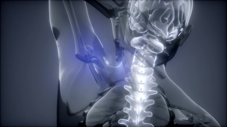 Backache in Back Bones