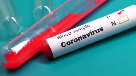 coronavirus blood sample test