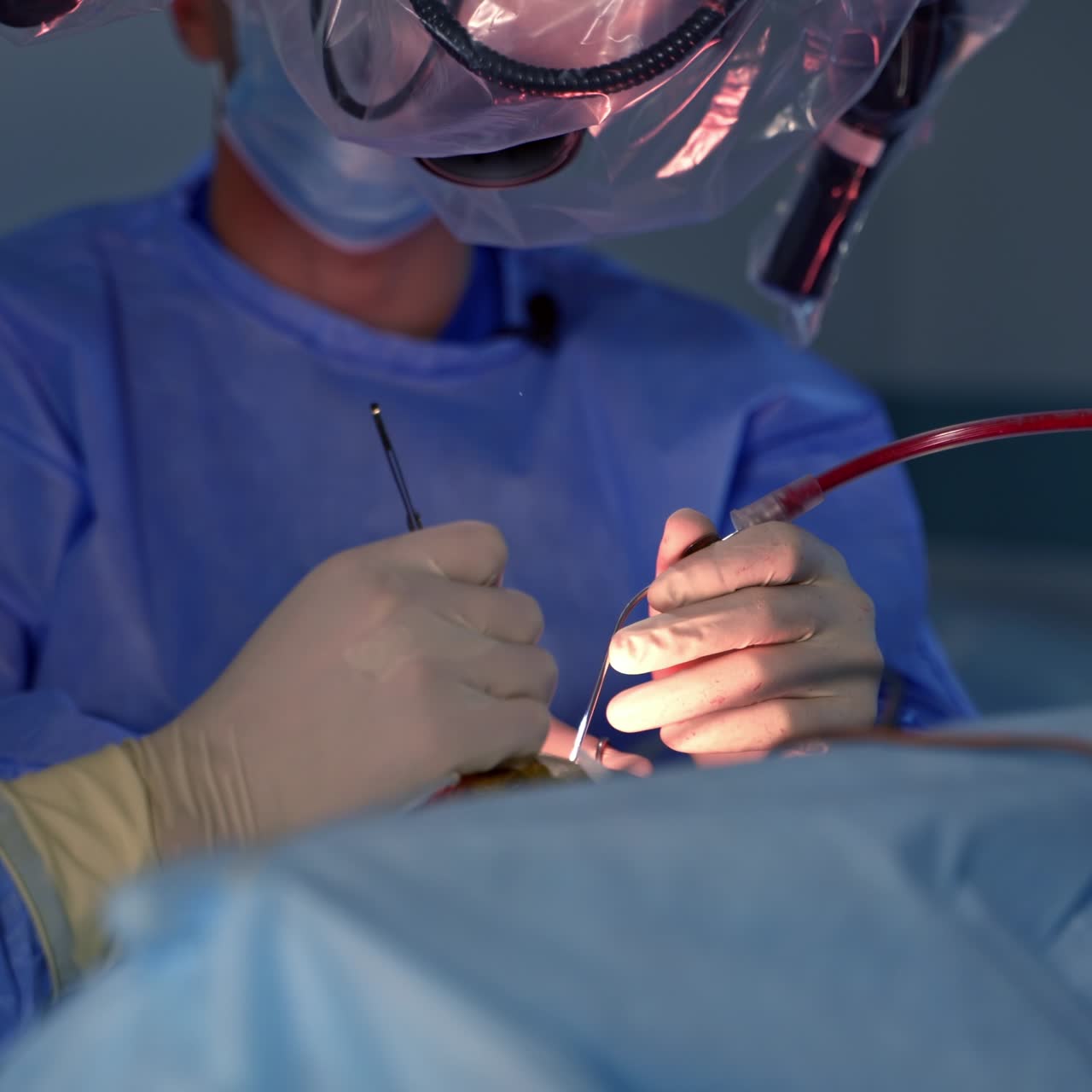 Surgical team st work operating. Neurosurgery specialists working together