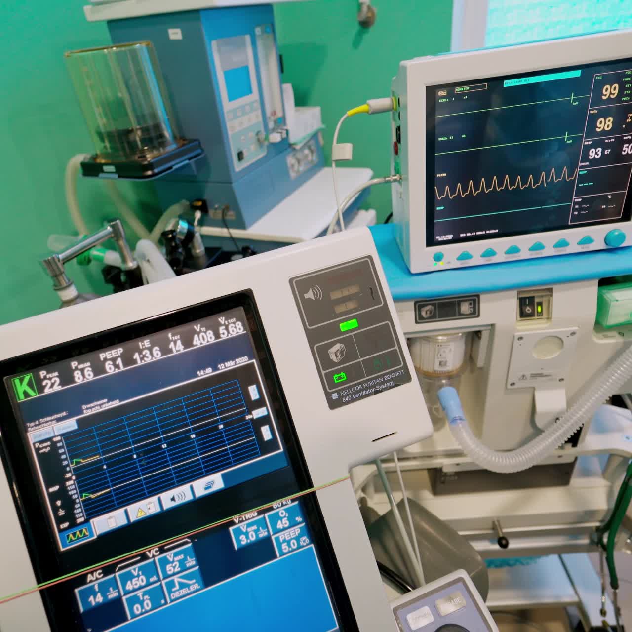 New hospital equipment in the intensive care unit. ICU medical monitor showing patient's condition. Modern equipment in the reanimation room.