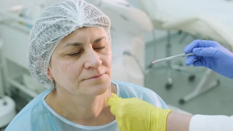 marcado antes de los procedimientos para el rejuvenecimiento de la piel de la cara. cosmetología de hardware profesional