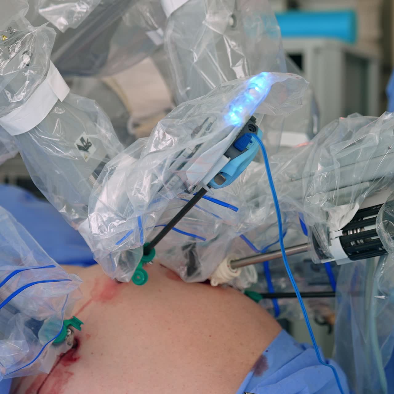 Technological robotic arms covered in protective plastic moving carefully during operation. Da Vinci robot operating the patient