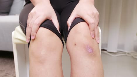 mujer con dolor de rodilla el concepto de prevenir la fatiga de las piernas y el automasaje