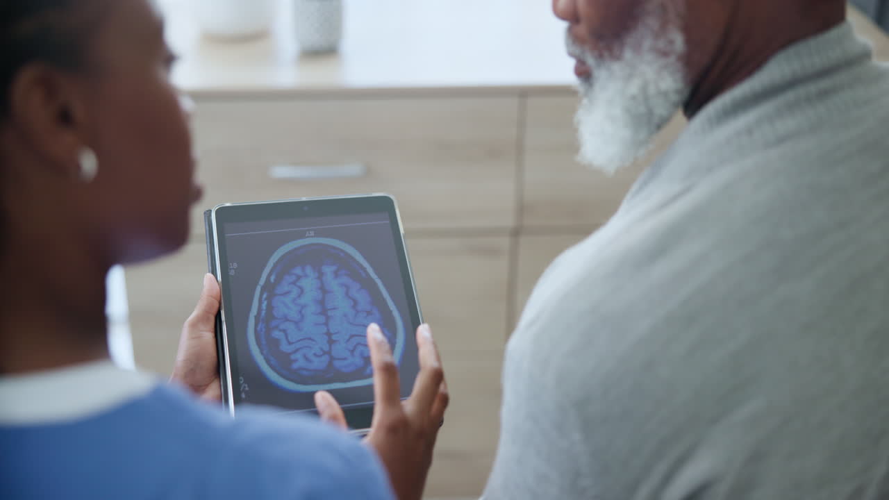 el médico discutiendo el escáner cerebral con el paciente