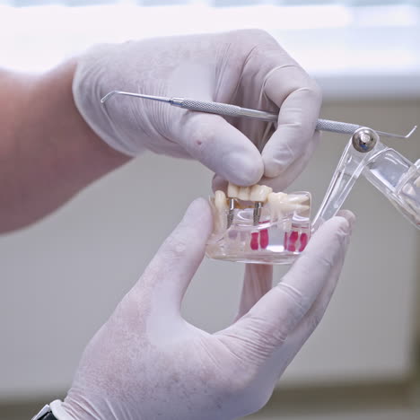 close-up artificial teeth in hands. stomatologist in white sterile gloves shows on jaw model how to put missing teeth.