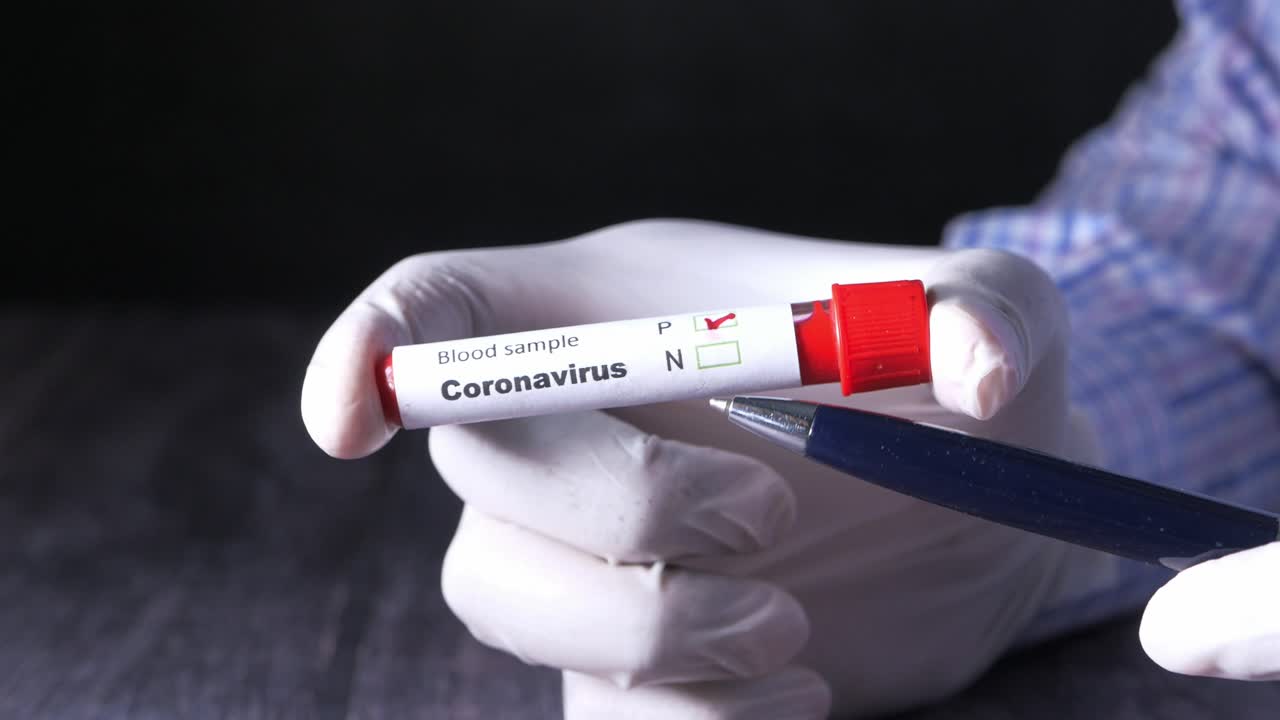 Test del campione di sangue per Coronavirus