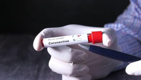 coronavirus blood sample test