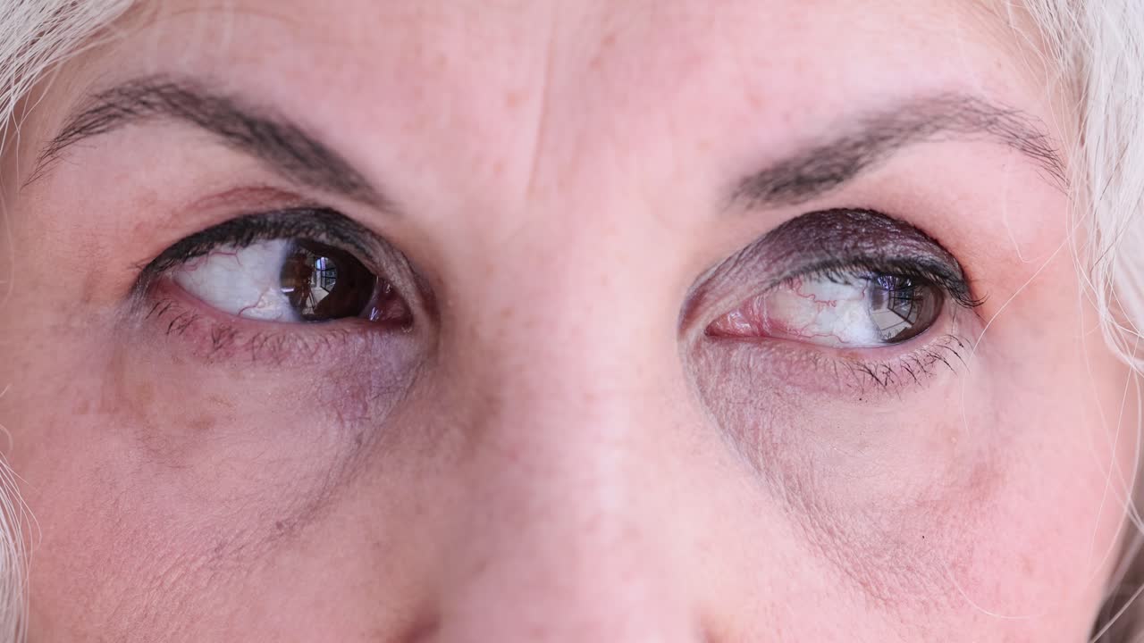 Close-up of elderly person's eyes with visible capillaries and wrinkles