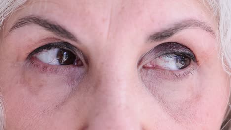 close-up of elderly person's eyes with visible capillaries and wrinkles