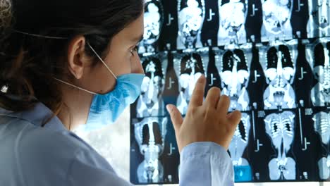 close-up-of-female-doctor-discussing-an-MRI-scan