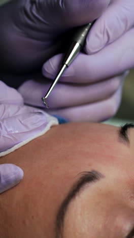 cosmetology professional uses blackhead removing tool in the procedure of skin cleaning. beauty salon skincare. extreme close up. vertical video