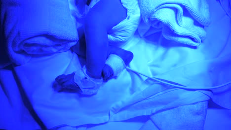 Fragile-newborn-in-neonatal-incubator