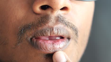 close-up of a man's face with skin discoloration around the mouth