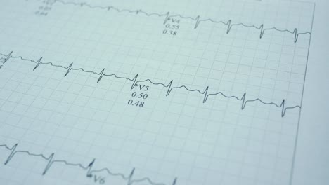 전기 심장 사진 (ecg)