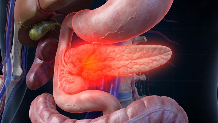 Pancreas glowing bright red under the stomach with pain radiating toward the back in a side view of the torso anatomy