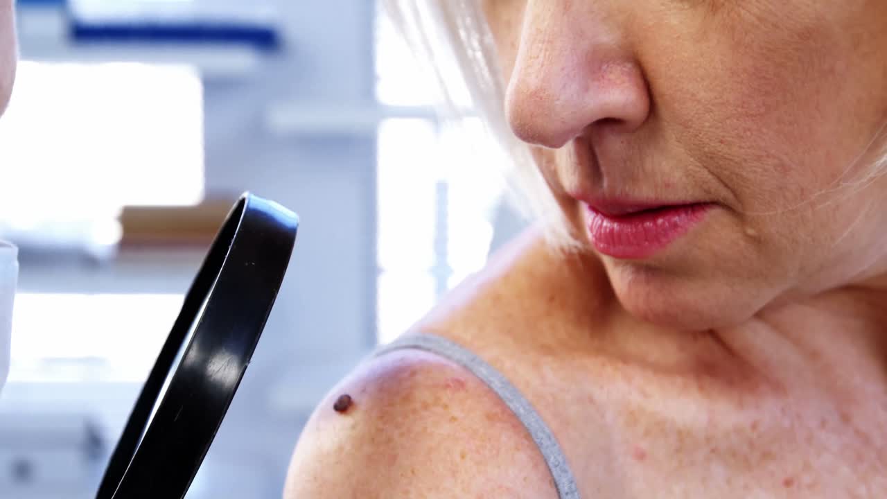 피부과 의사가 확대 유리로 모를 검사 하고 있다