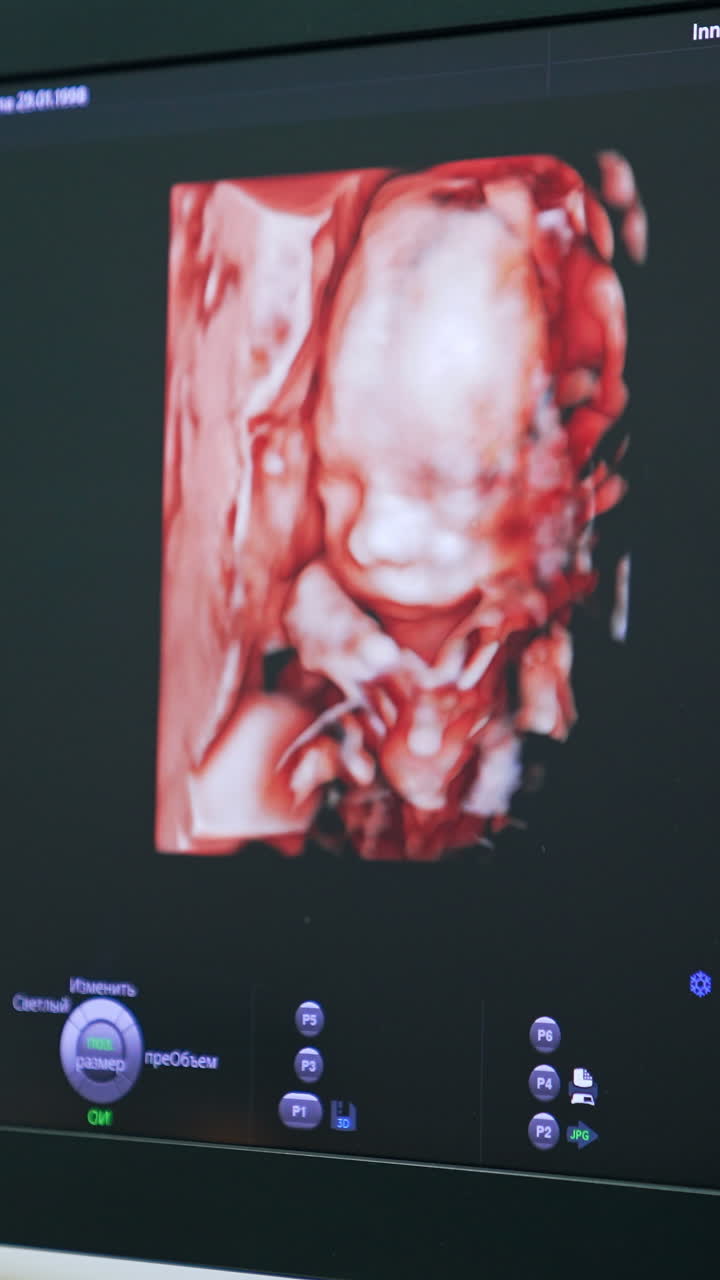 Cute baby image on the monitor of the ultrasound machine. Intrauterine development of a child. Vertical video