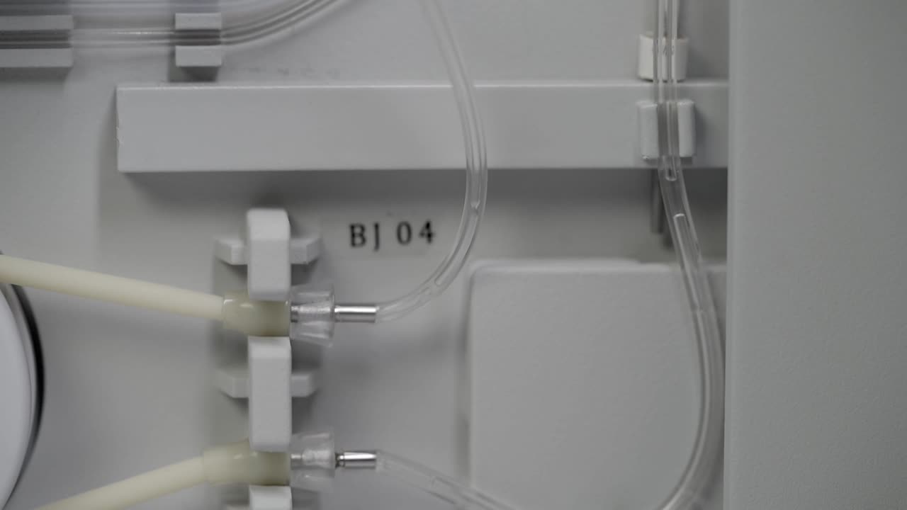 líquido que corre a través de los tubos en la máquina de sangre cbc