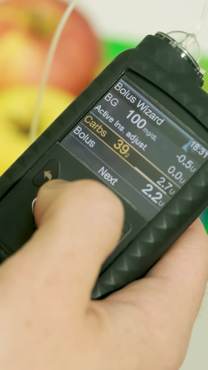 Close-up of Hand Adjusting Insulin Pump Settings for Bolus Calculation