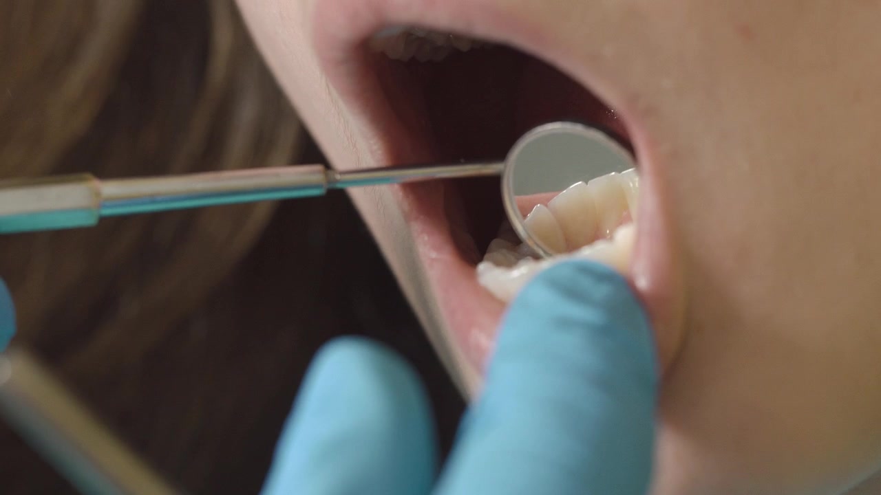 Dentista che esamina i denti del paziente con specchietto dentale e sonda