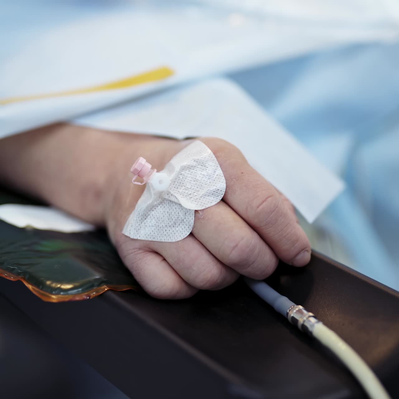 Hand without movement during surgery. Patient's hand is on the operating table with special equipment connected to his finger. Close-up.