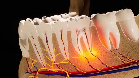 los dientes molares dañados por la caries. animación 3d del diente médicamente precisa