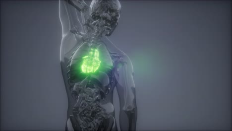 examen de radiología del corazón humano