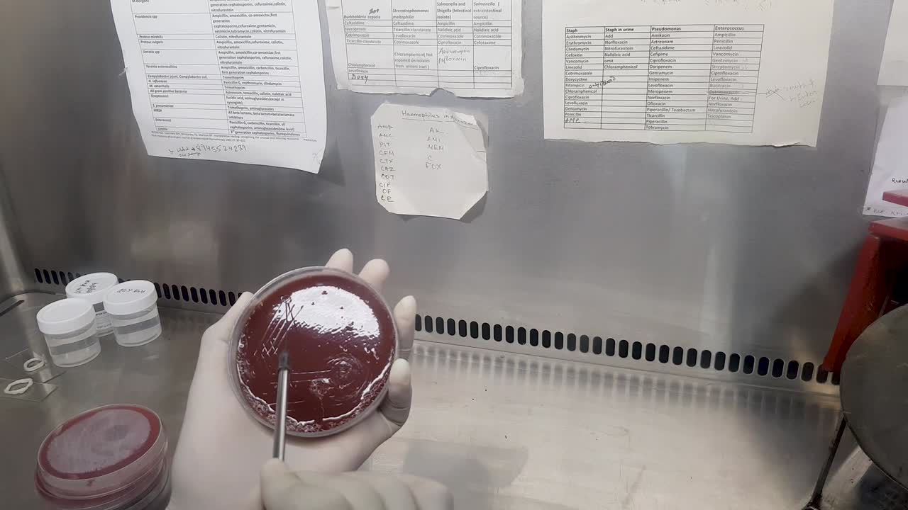 플을 초콜릿 아가르 배양판에 접종 루프로 접종합니다.