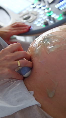 woman at ultrasound examination. big pregnant belly with applied gel and doctor's hand with device for ultrasonic check up. vertical video