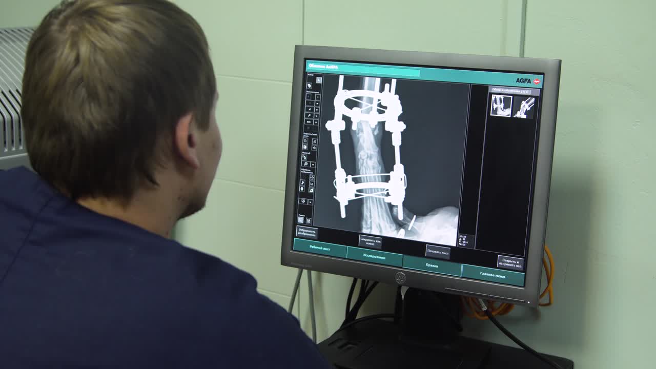 Doctor looking at an x-ray in a hospital