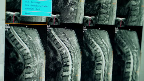 view of x-ray image. x-ray scan of the patient