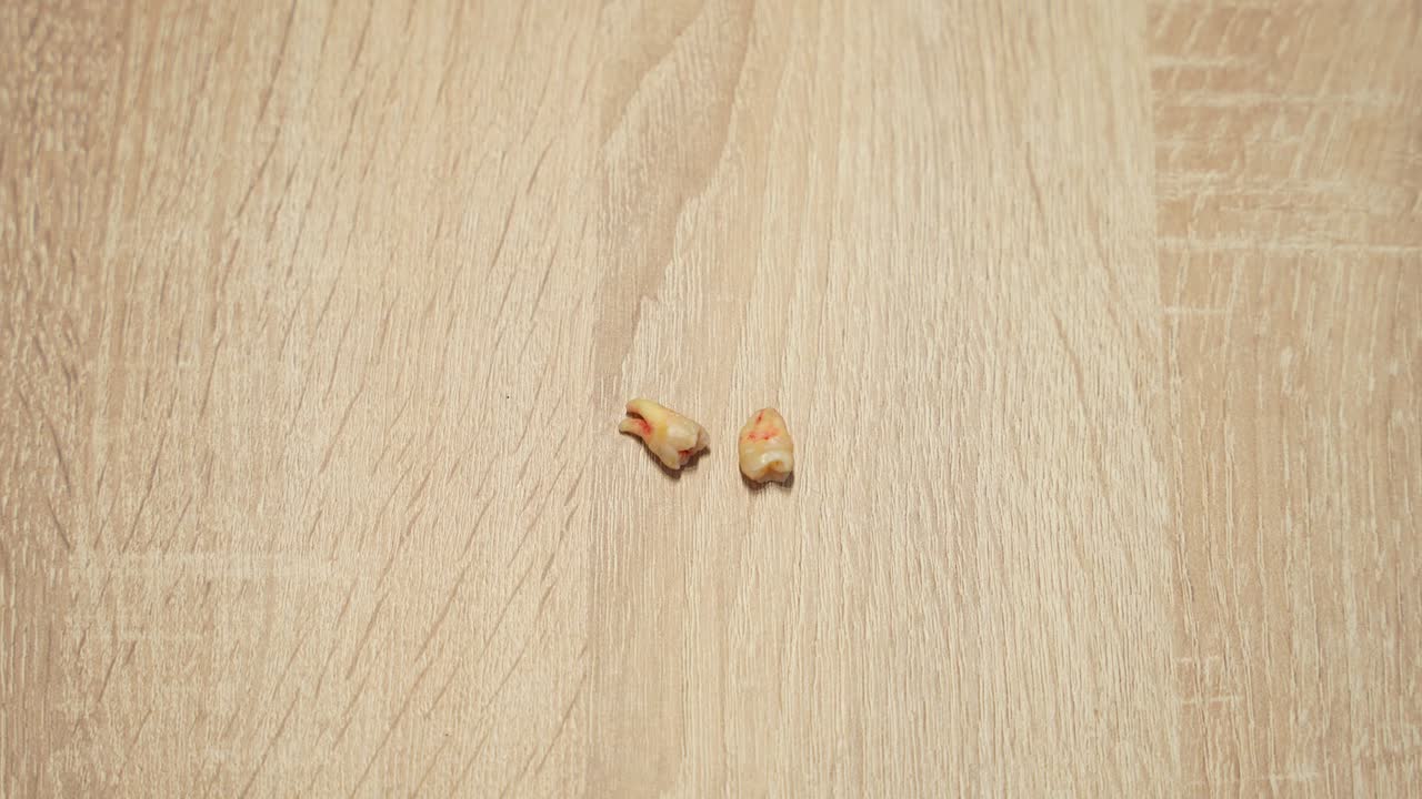 나무 테이블 에 새로 뽑은 두 개의 지혜 치아