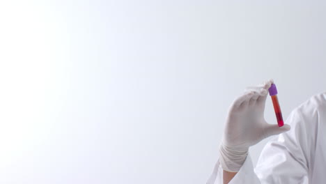 mano con guante médico sosteniendo una muestra de sangre sobre fondo blanco con espacio de copia, cámara lenta