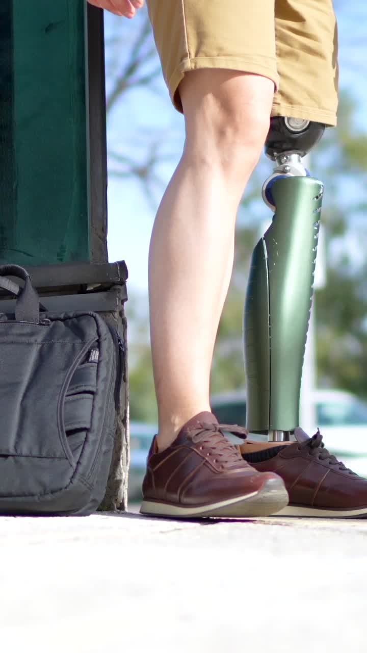 Person with prosthetic leg and work bag
