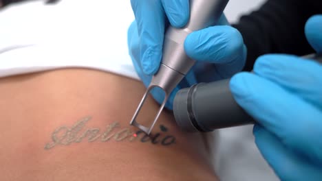 girl erasing tattoo of exboyfriend name, deleting or removing