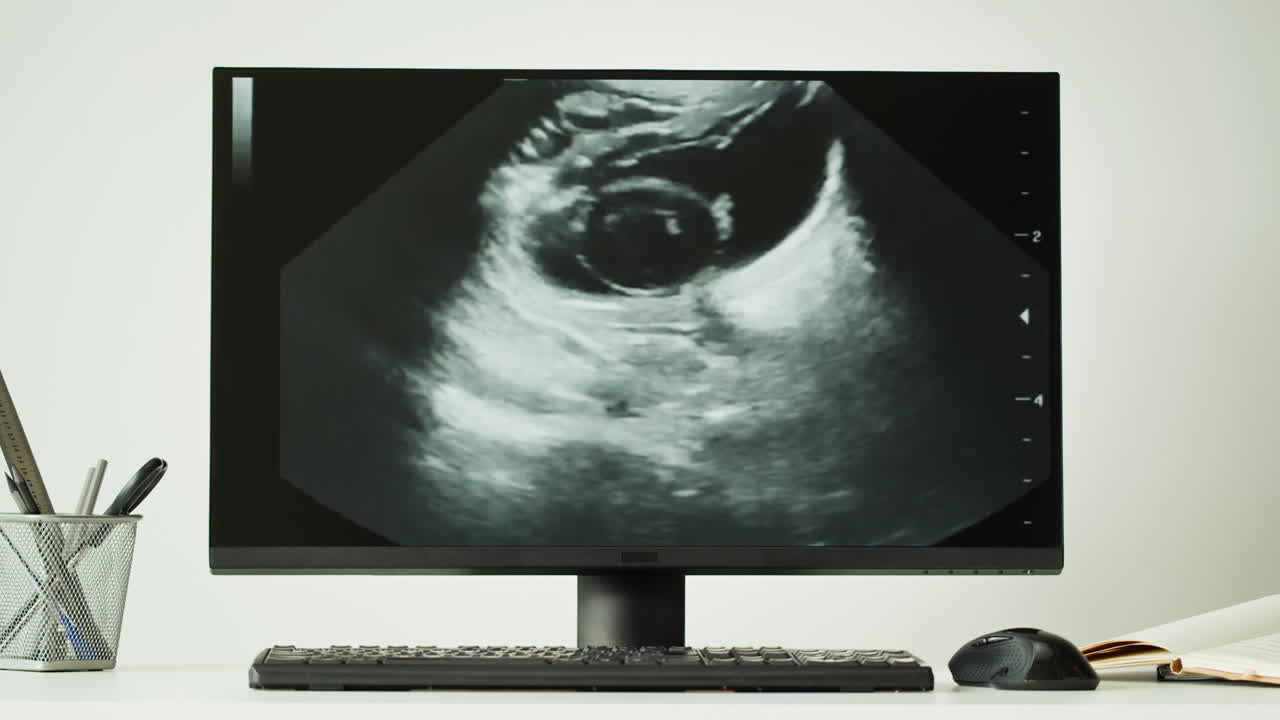 Medico che esamina un'ecografia