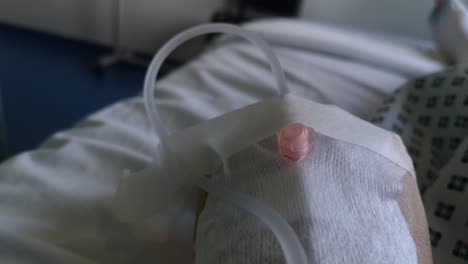primer plano de la mano vendada de un paciente con una línea iv mientras yacía en una cama de hospital