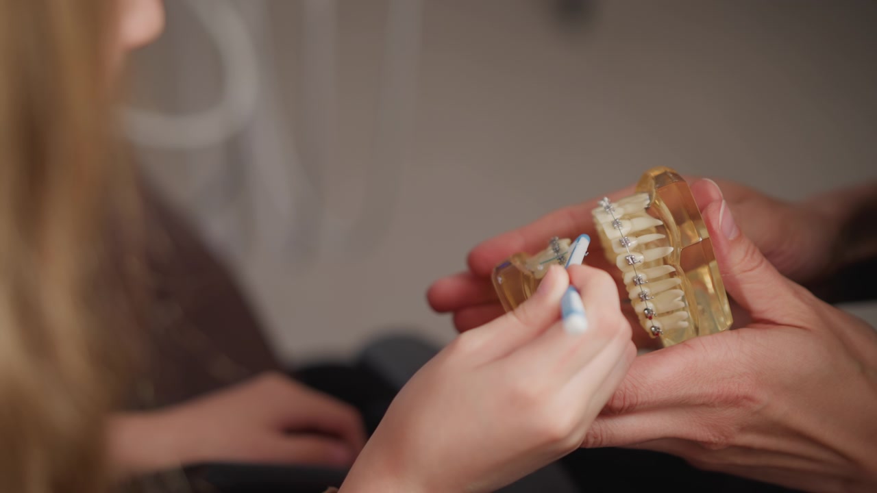 Un professionista dentale dimostra la corretta tecnica di spazzolamento su un modello in plastica trasparente di denti con apparecchio, mostrando una cura dettagliata per gli apparecchi ortodontici. La scena presenta primi piani.