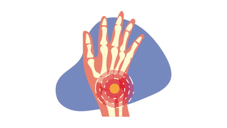 hand human bones pain animation