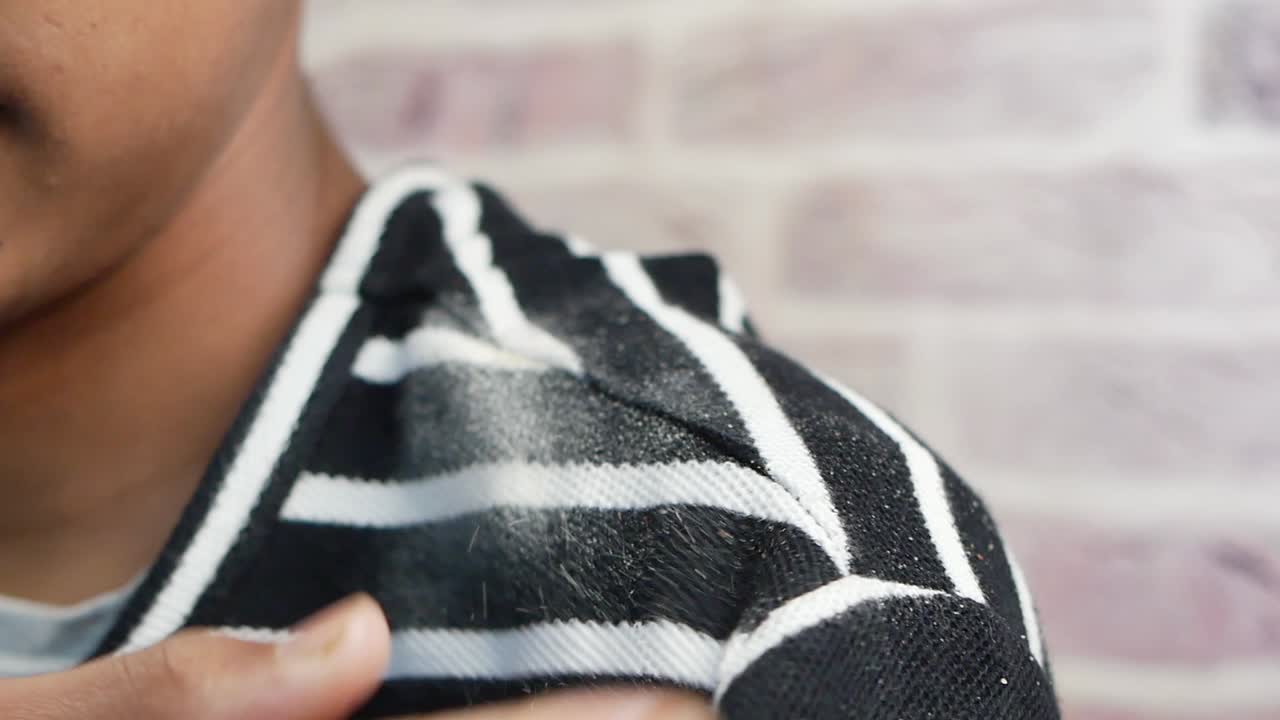 persona rascándose el hombro con polvo o caspa en la camisa a rayas