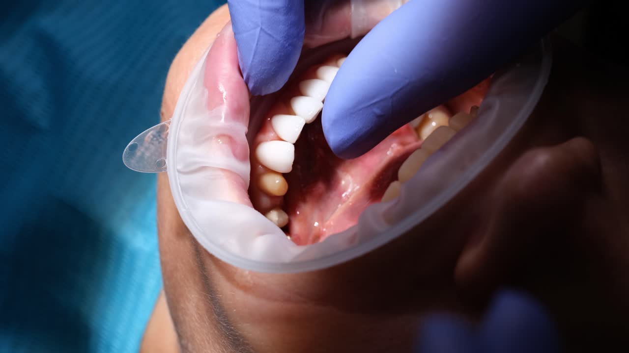 Dentist performing a dental procedure on a patient