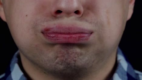 primer plano de la boca de una persona con úlceras en los labios