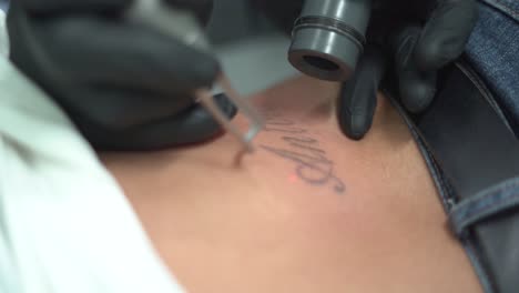 woman remove tattoo, deleting or erasing