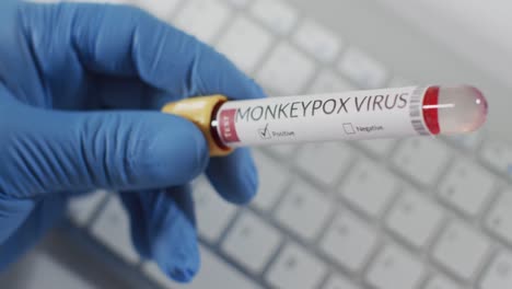 Hand-of-doctor-holding-vial-with-monkeypox-virus-over-keyboard