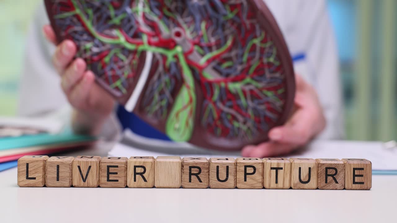 Doctor holds anatomical model of liver to show possible injuries