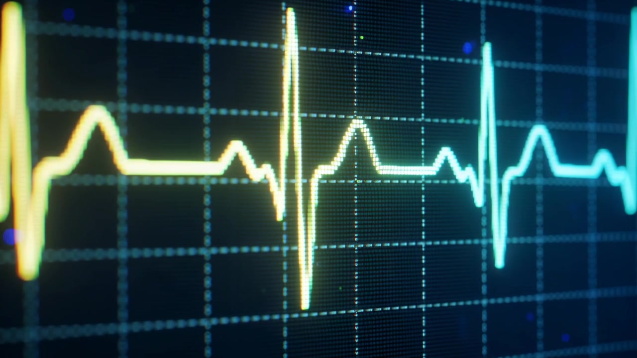 Traccia ECG pulsante su griglia del monitor che si muove verso destra con battiti cardiaci che causano picchi, monitorando il ritmo.