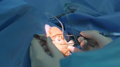 eye surgery, vitreoretinal. vitrectomy surgery.