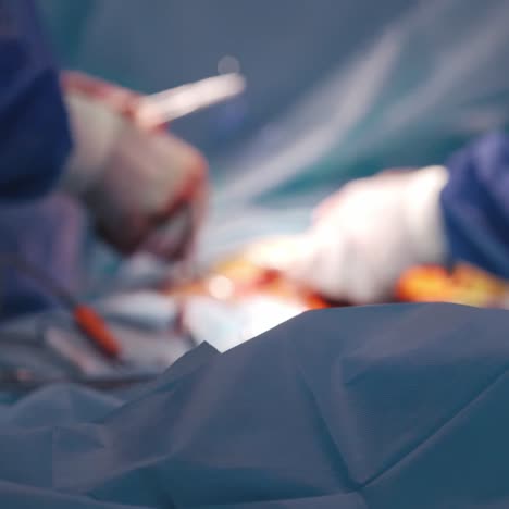 operating procedure by specialists in hospital. blurred background of surgeon's hands during the operation. close-up.
